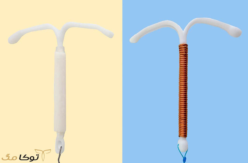 دستگاه داخل رحمی (IUD)