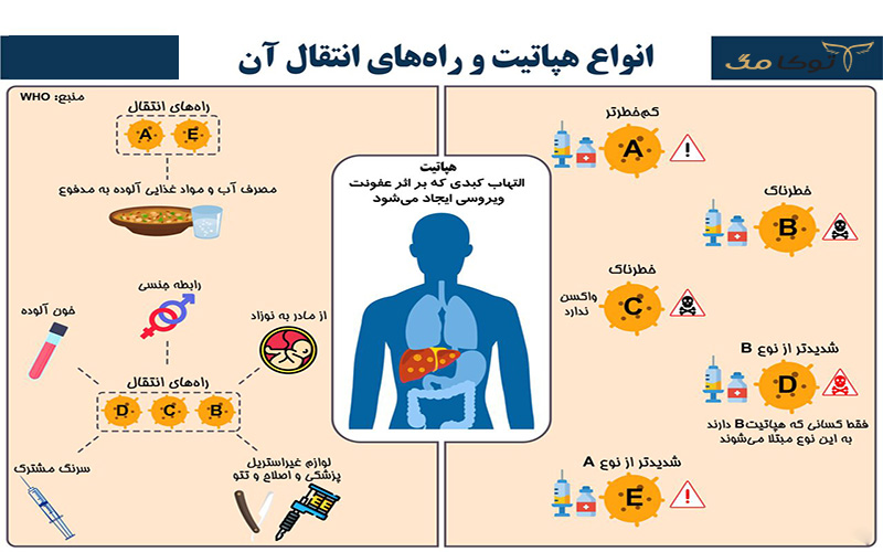 آشنایی با انواع هپاتیت