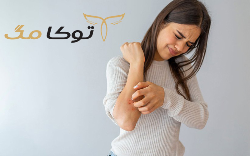 علت خشکی پوست بدن همراه خارش