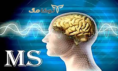 آشنایی با علائم بیماری MS