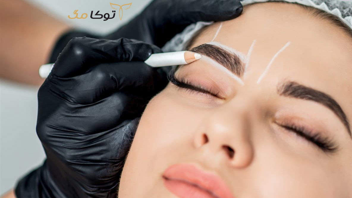 فیبروز ابرو چیست و چگونه انجام می‌شود؟