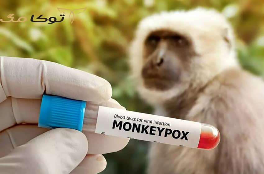 آشنایی با بیماری آبله میمون