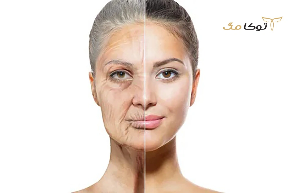 چه افرادی کاندید های مناسبی برای جراحی لیفت صورت هستند؟