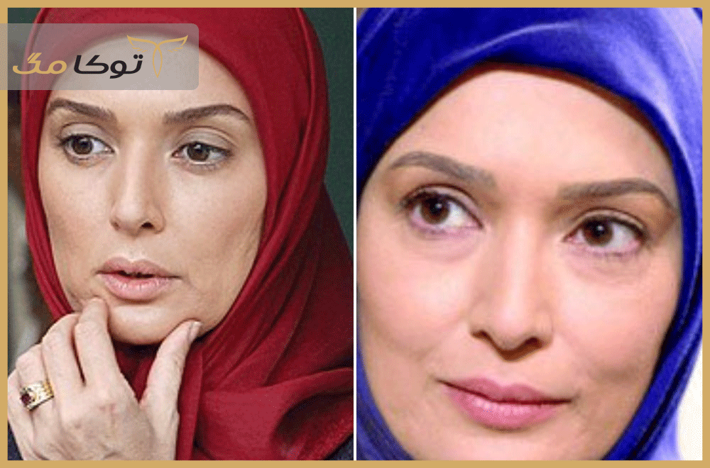 بیماری