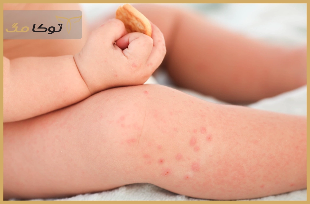 چطور بفهمم نوزادم به دستمال مرطوب حساسیت دارد؟