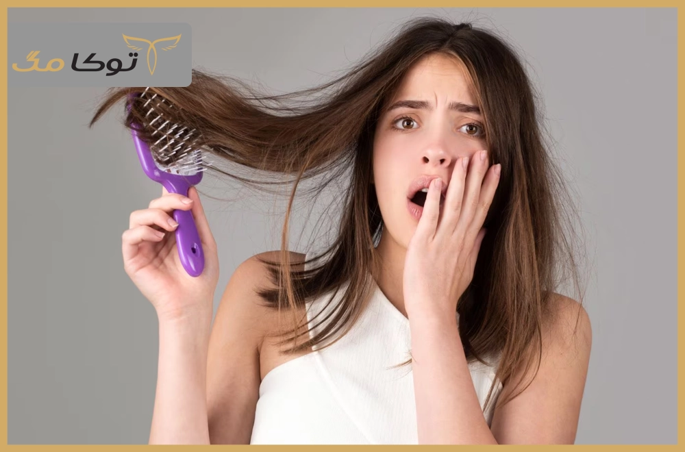 ریزش مو