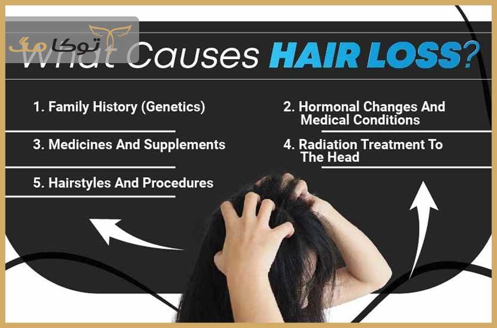 دلایل اصلی ریزش مو
