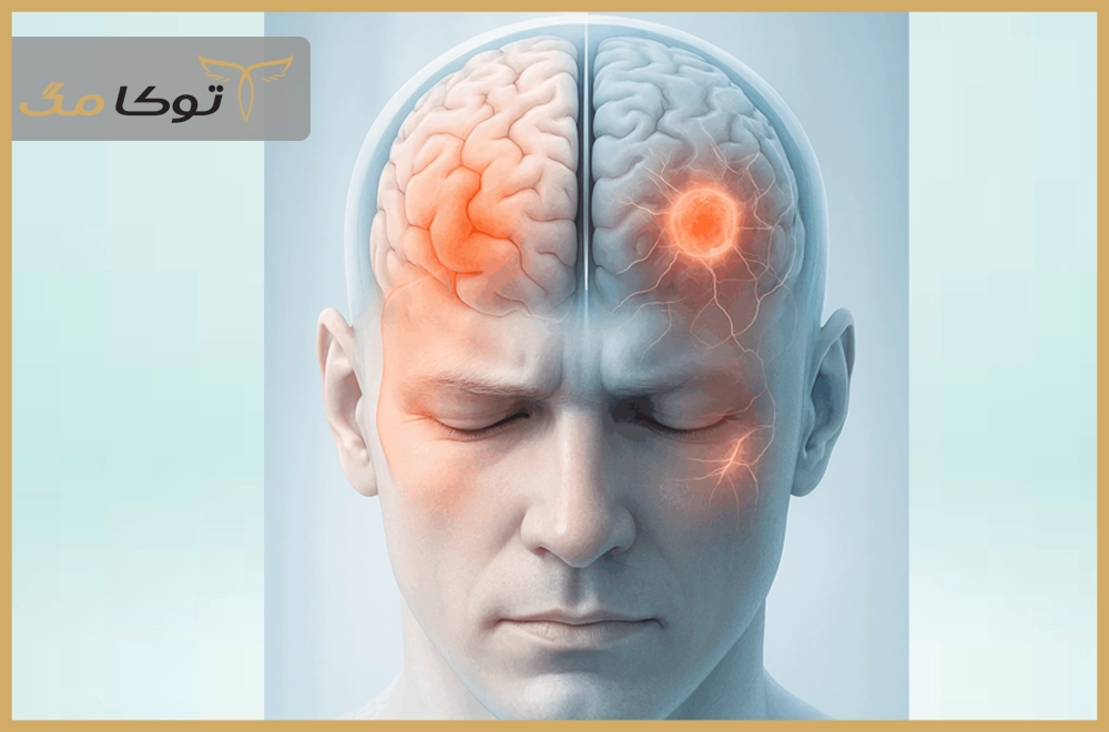 تومور مغزی