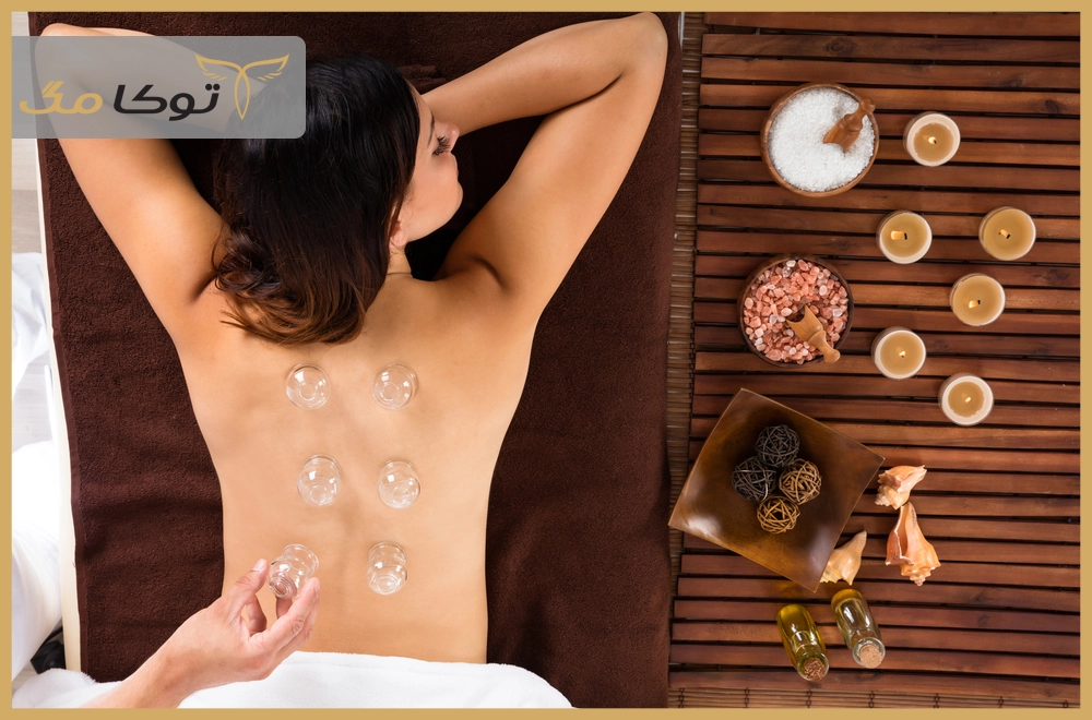 حجامت (Cupping Therapy) به چه معناست