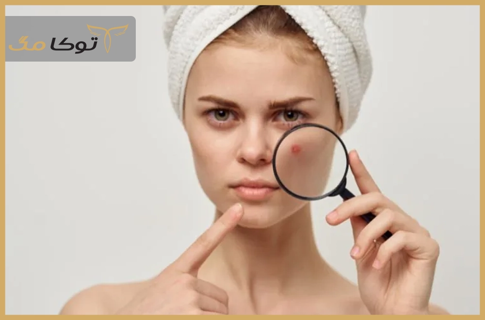 چرا شناخت نوع پوست اینقدر اهمیت دارد؟
